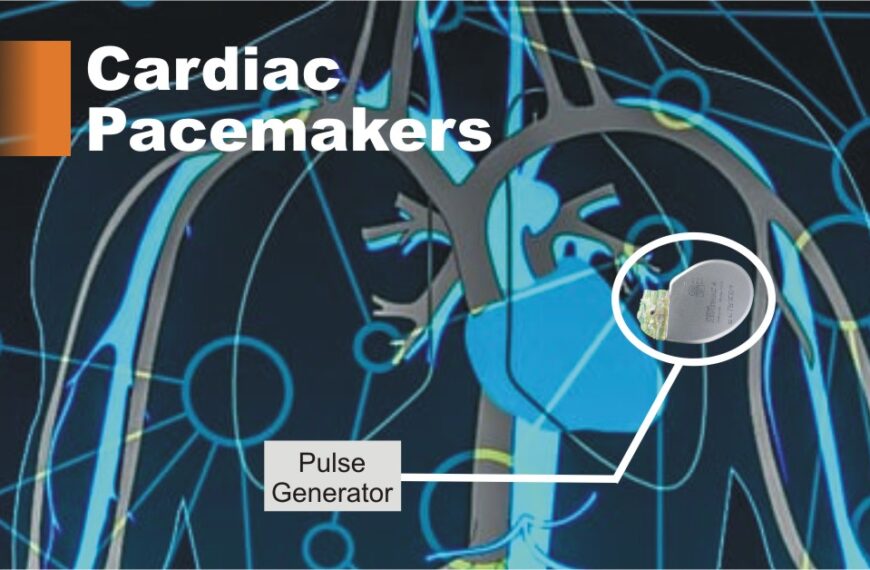 pacemaker of the heart